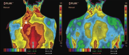 Scientific thermal split image, before and after, of the back of a man after being grounded for for nights